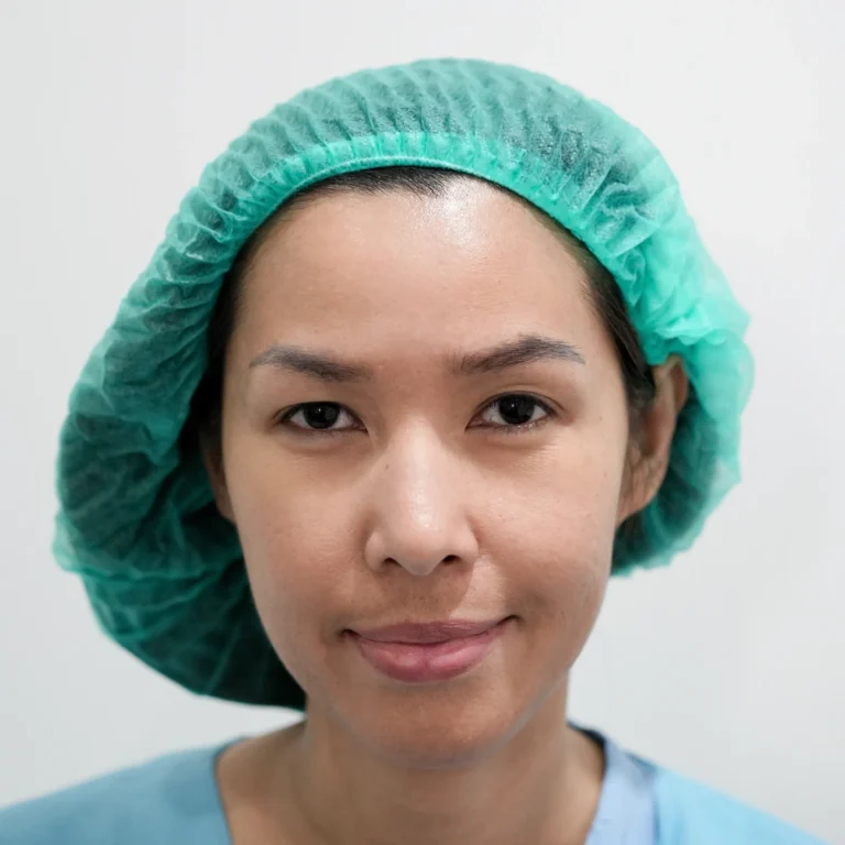 facial-fat-grafting-00043
