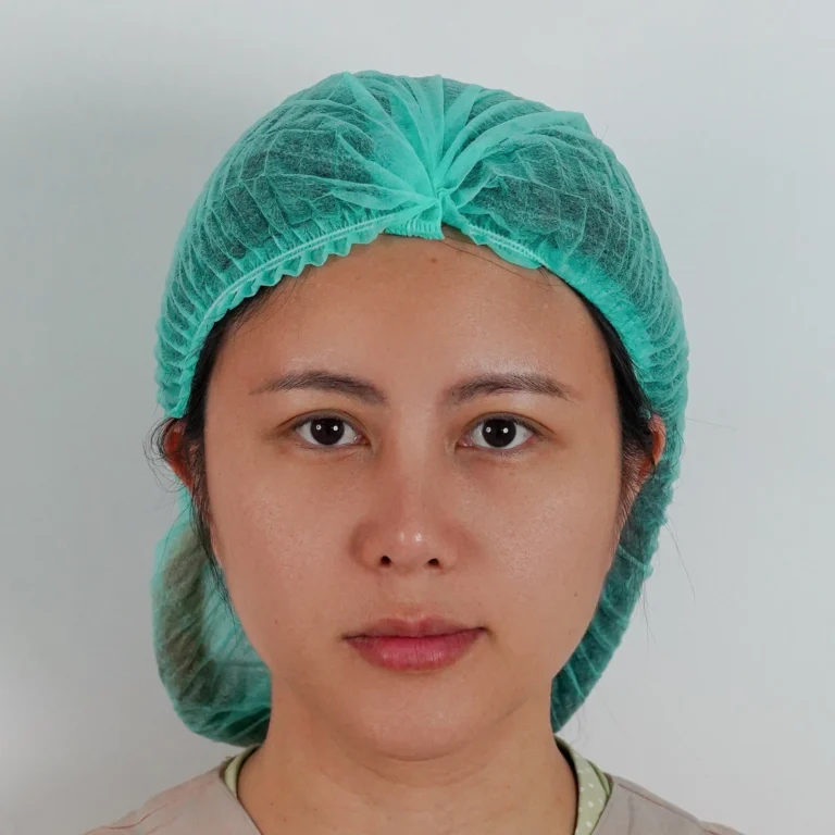 facial-fat-grafting-00044