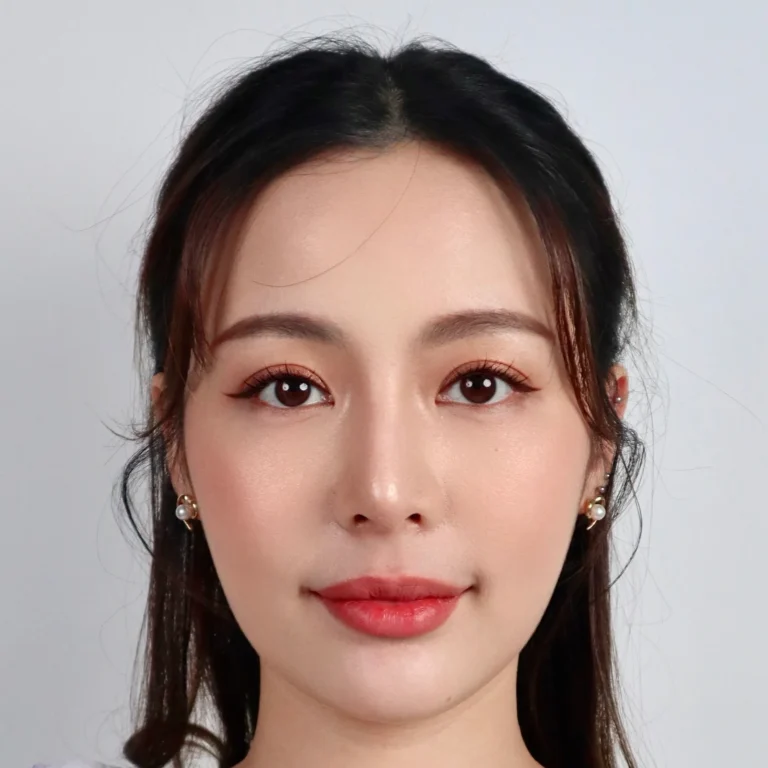 facial-fat-grafting-00047
