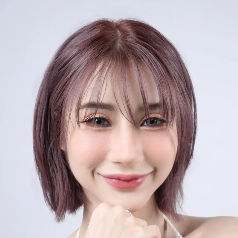 facial-fat-grafting-00049