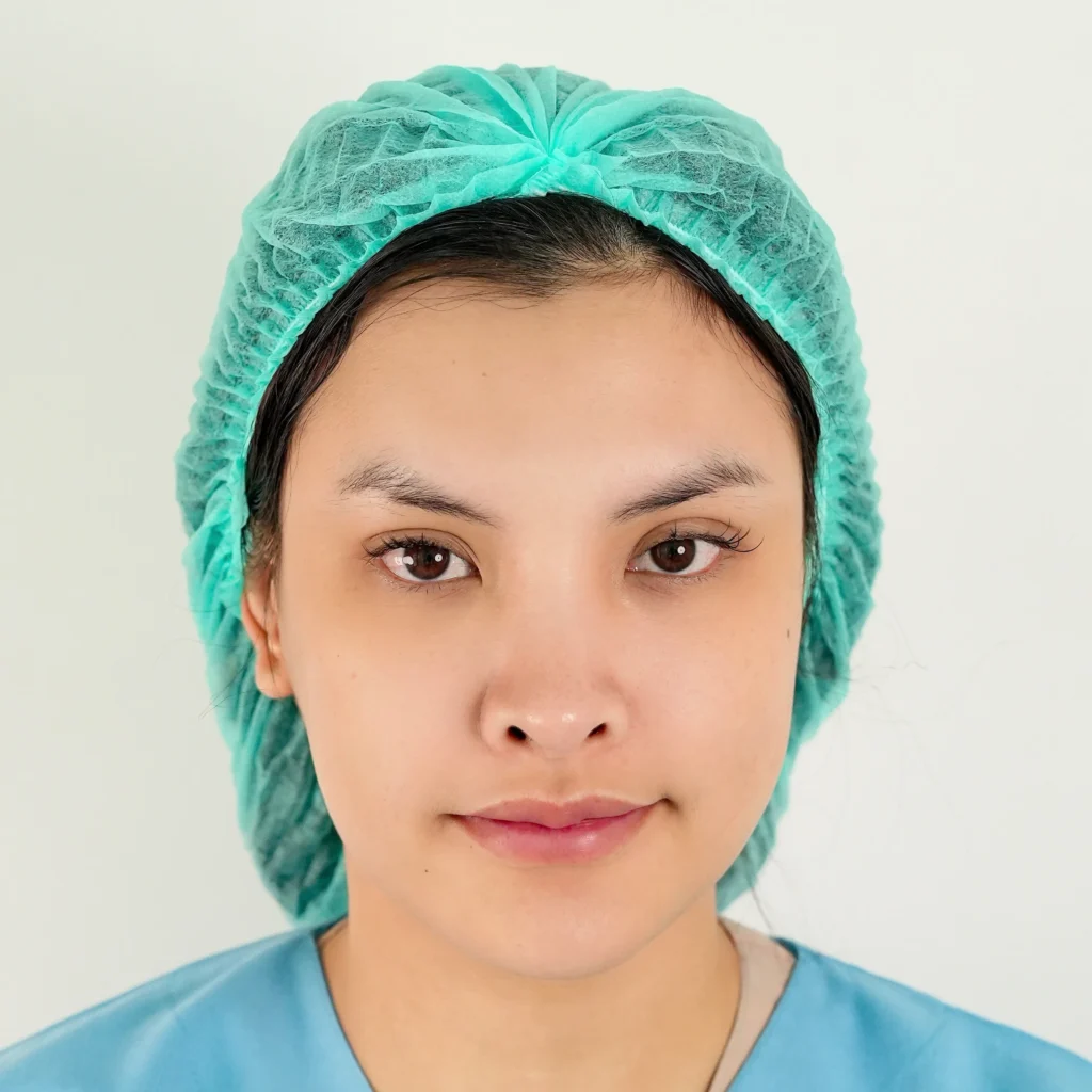 facial-fat-grafting-00053