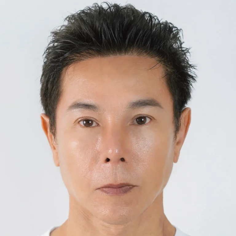 facial-fat-grafting-00058