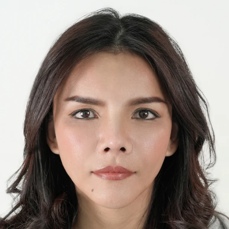 facial-fat-grafting-00061