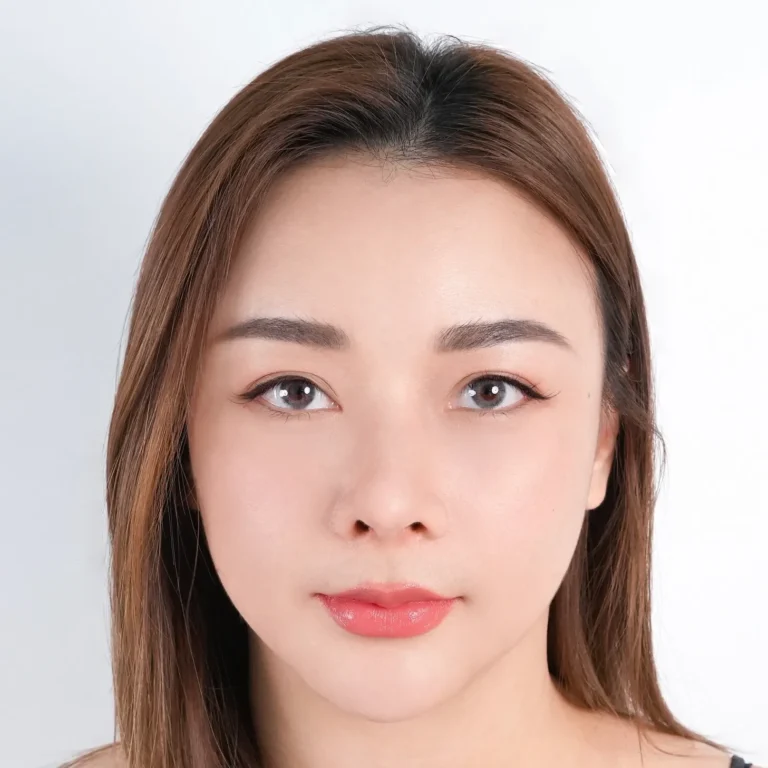 facial-fat-grafting-00065