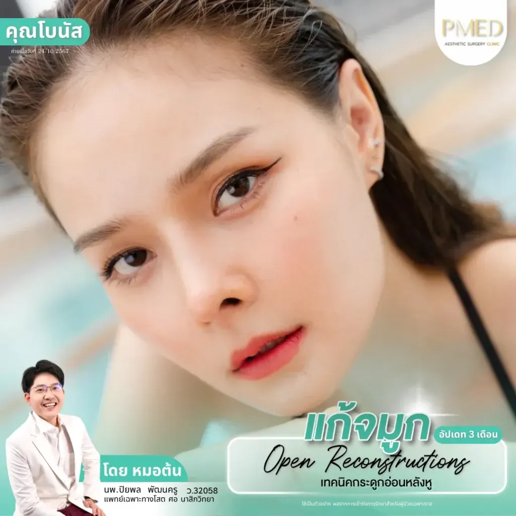 rib-cartilage-000038