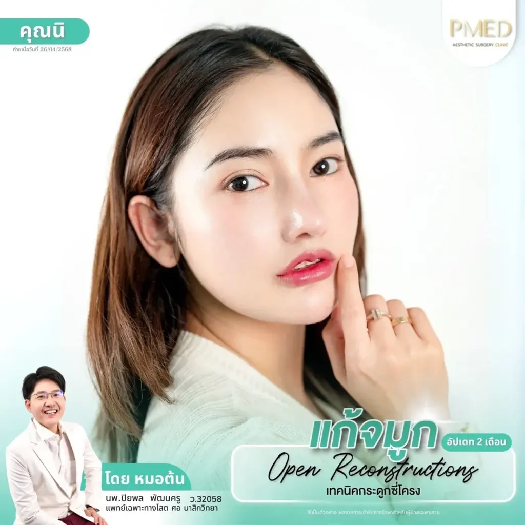rib-cartilage-000044