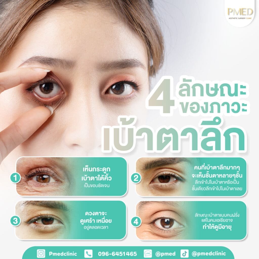 ฉีดไขมันใต้ตาคืออะไร? เทคนิคคืนความอ่อนเยาว์ให้ใบหน้าอย่างเป็นธรรมชาติ