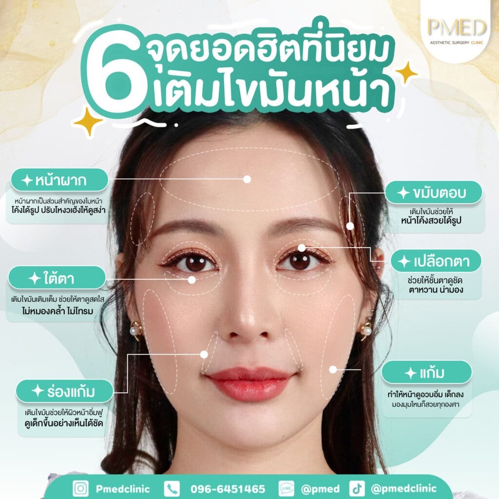 ฉีดไขมันหน้าให้ดูอ่อนเยาว์ เทคนิคคืนความสดใสอย่างเป็นธรรมชาติ