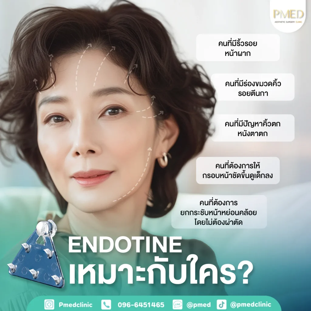 Endotine คืออะไร? ยกกระชับใบหน้าอย่างเป็นธรรมชาติด้วยเทคนิคศัลยกรรมสมัยใหม่