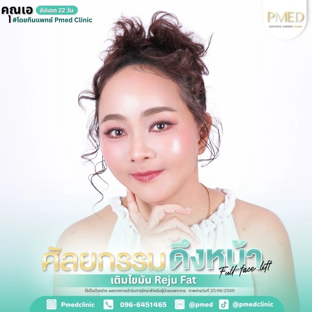 LINE_ALBUM_ดึงหน้า Full Face Lift_260715_2