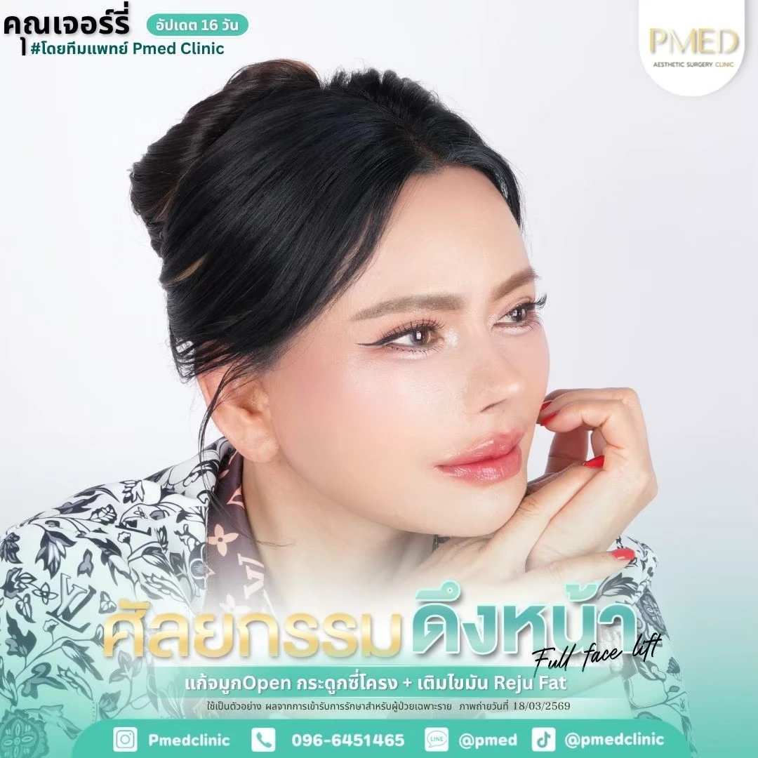 LINE_ALBUM_ดึงหน้า Full Face Lift_260715_3