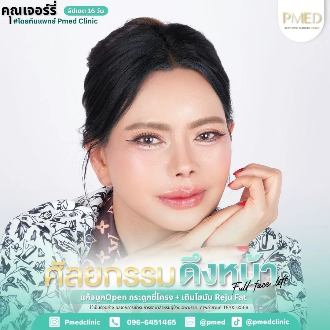 LINE_ALBUM_ดึงหน้า Full Face Lift_260715_4