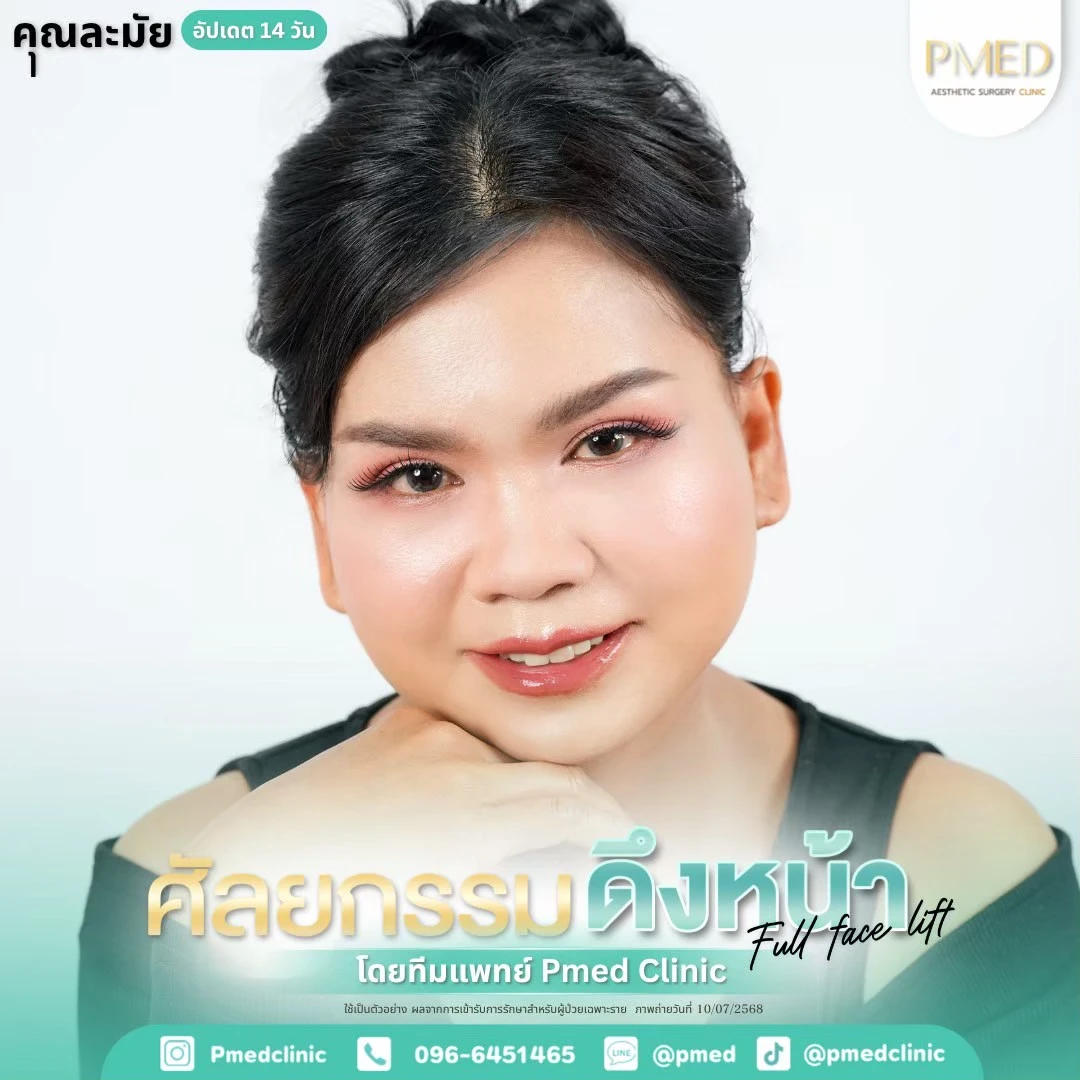 LINE_ALBUM_ดึงหน้า Full Face Lift_260715_5