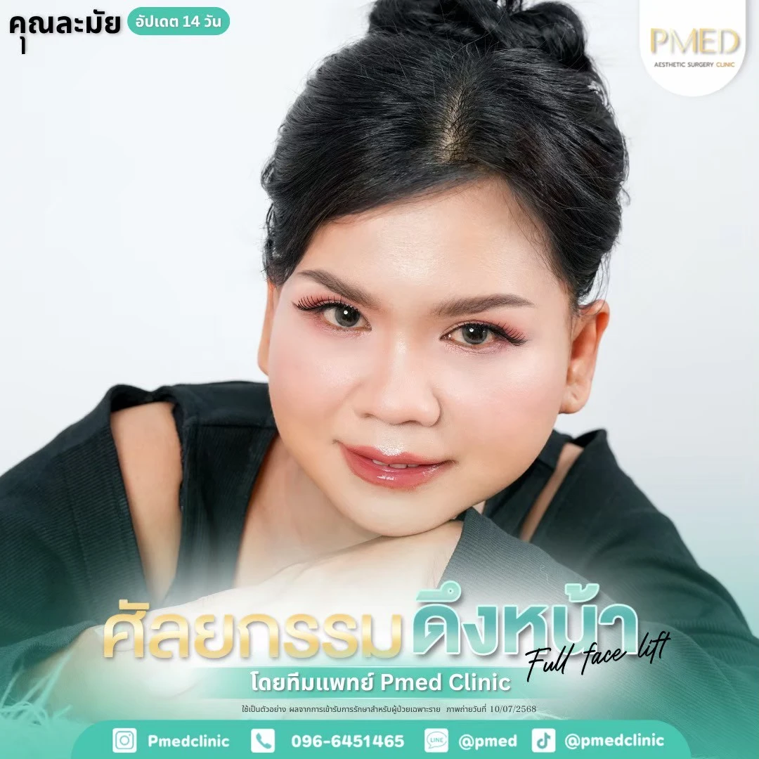 LINE_ALBUM_ดึงหน้า Full Face Lift_260715_6