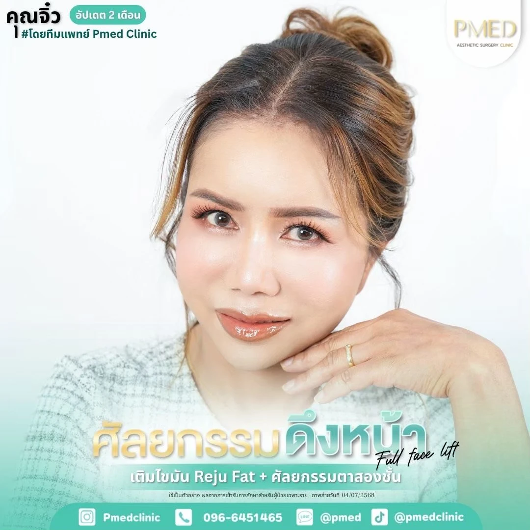 LINE_ALBUM_ดึงหน้า Full Face Lift_260715_7