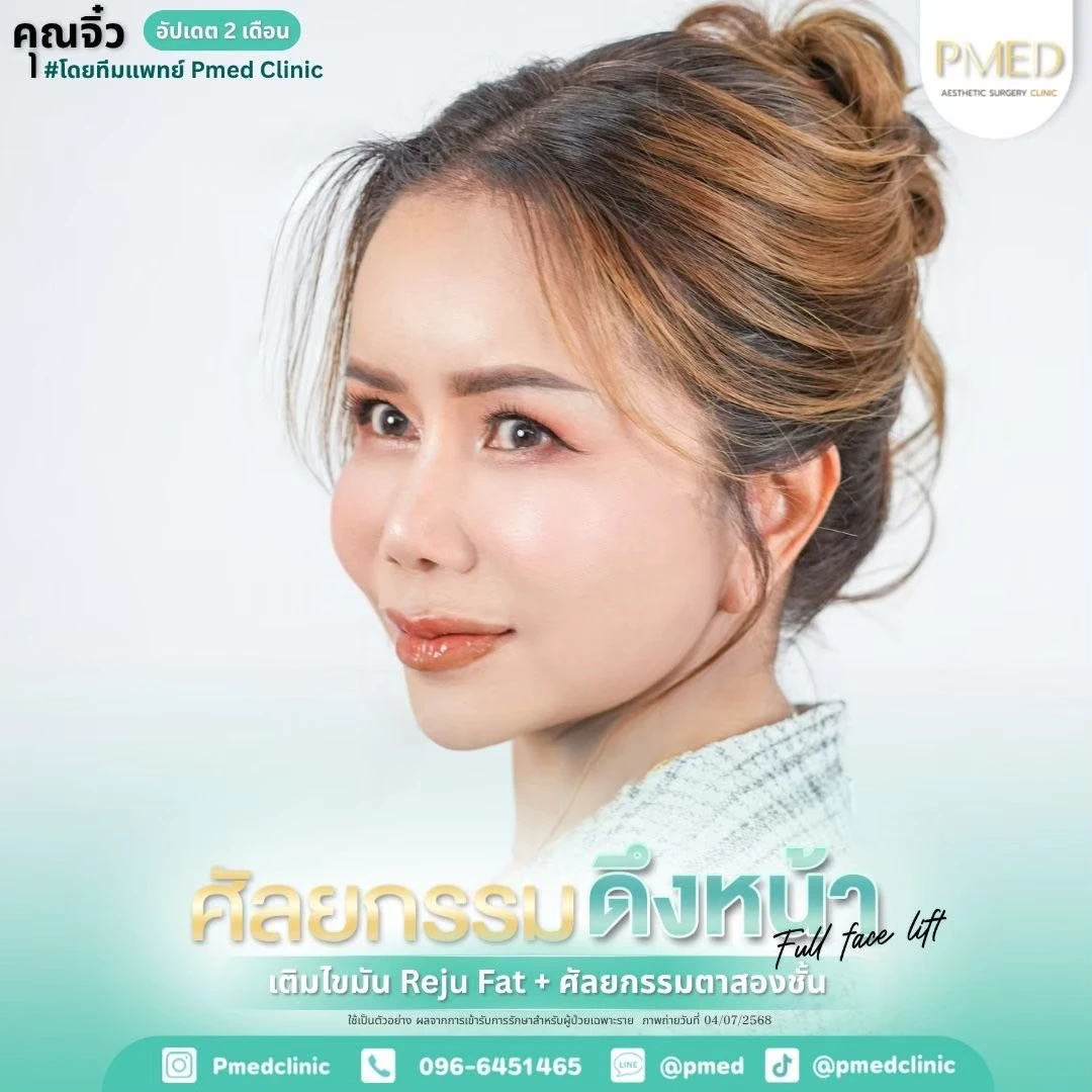 LINE_ALBUM_ดึงหน้า Full Face Lift_260715_8