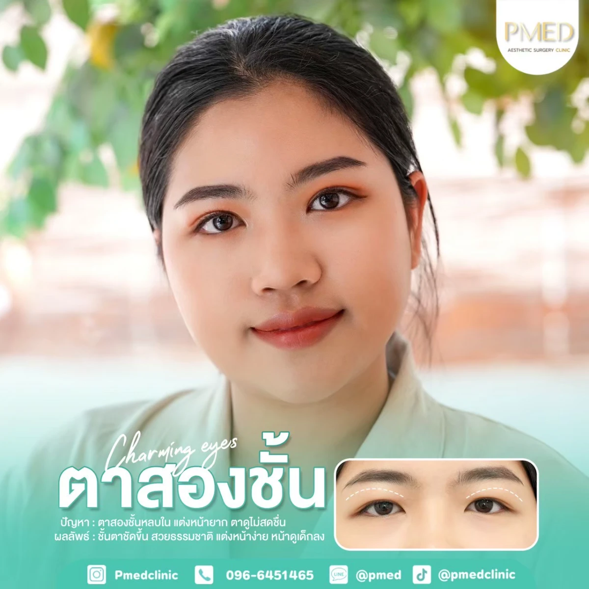 LINE_ALBUM_ตาสองชั้น 👁️_260715_18