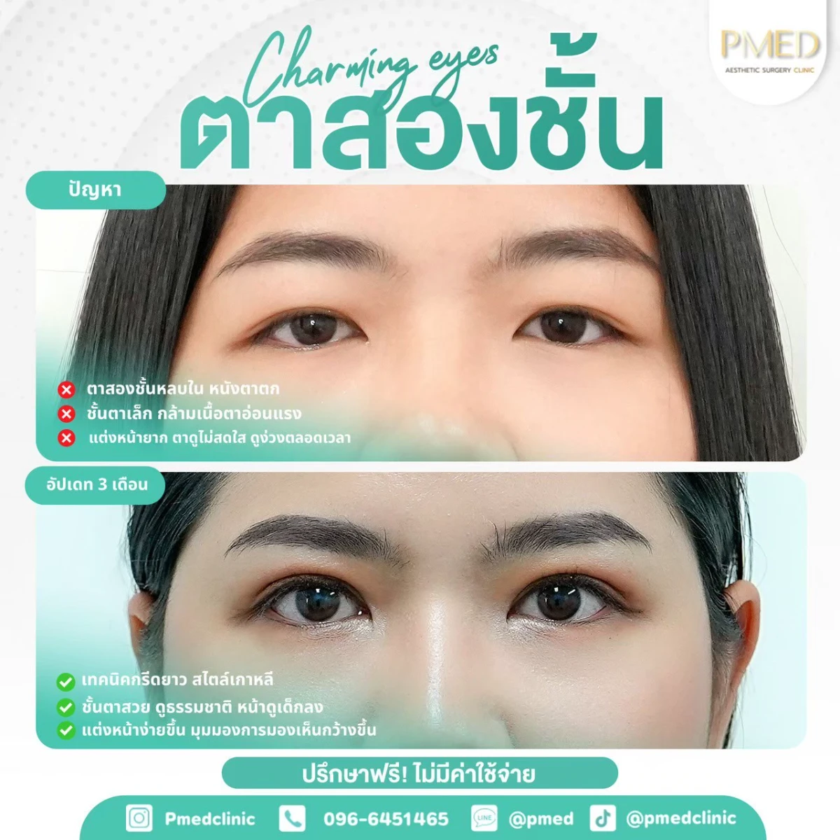LINE_ALBUM_ตาสองชั้น 👁️_260715_21