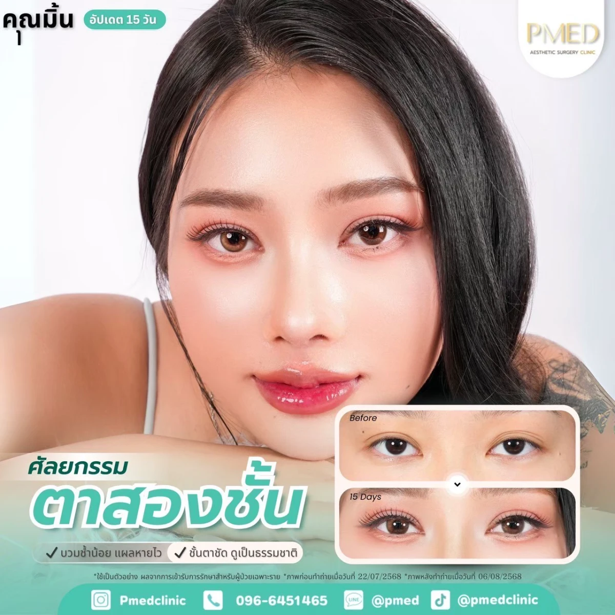 LINE_ALBUM_ตาสองชั้น 👁️_260715_9