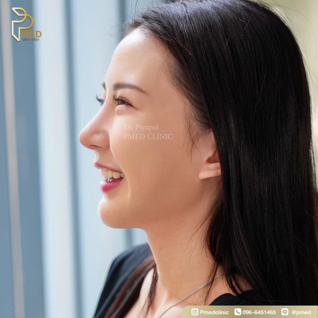 จมูกทรงสโลปปลายพุ่งคืออะไร? คู่มือเลือกทรงให้สวยละมุน ดูมีมิติ และเข้ากับใบหน้า