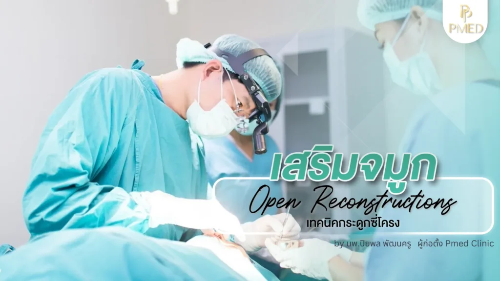 เสริมจมูกไร้ซิลิโคนคืออะไร? ทางเลือกใหม่สำหรับคนอยากจมูกสวยแบบไม่ต้องพึ่งวัสดุเทียม