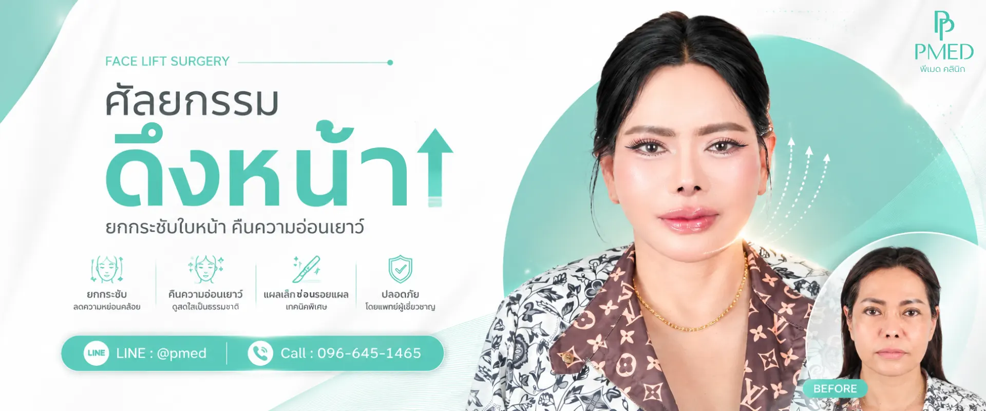 banner ศัยกรรมดึงหน้า 1