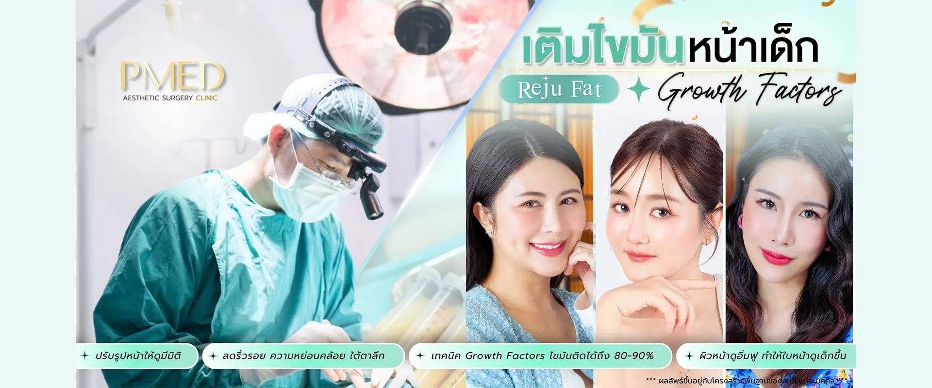 banner เติมไขมัน 4