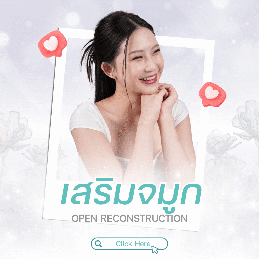 ประเภทของการเสริมจมูกที่ไม่ใช้ซิลิโคน ทางเลือกใหม่เพื่อความสวยอย่างเป็นธรรมชาติ