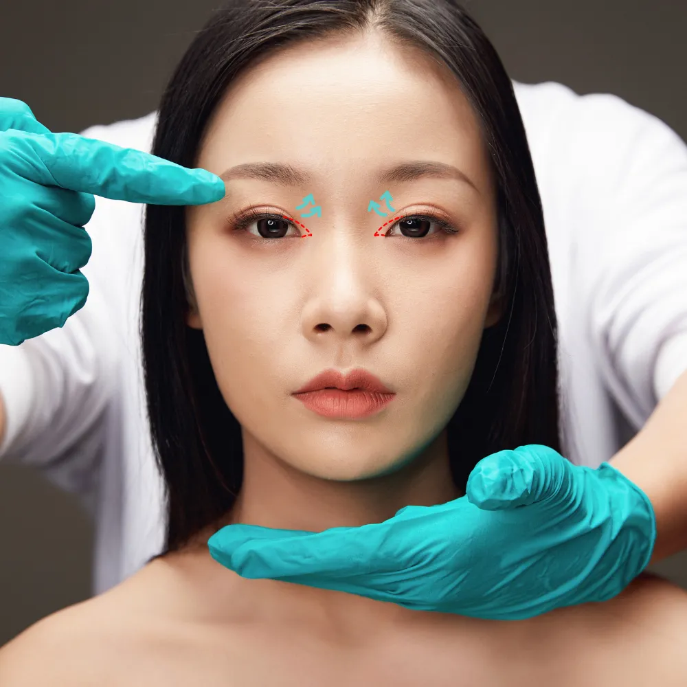 ฉีดไขมันใต้ตาคืออะไร? เทคนิคคืนความอ่อนเยาว์ให้ใบหน้าอย่างเป็นธรรมชาติ