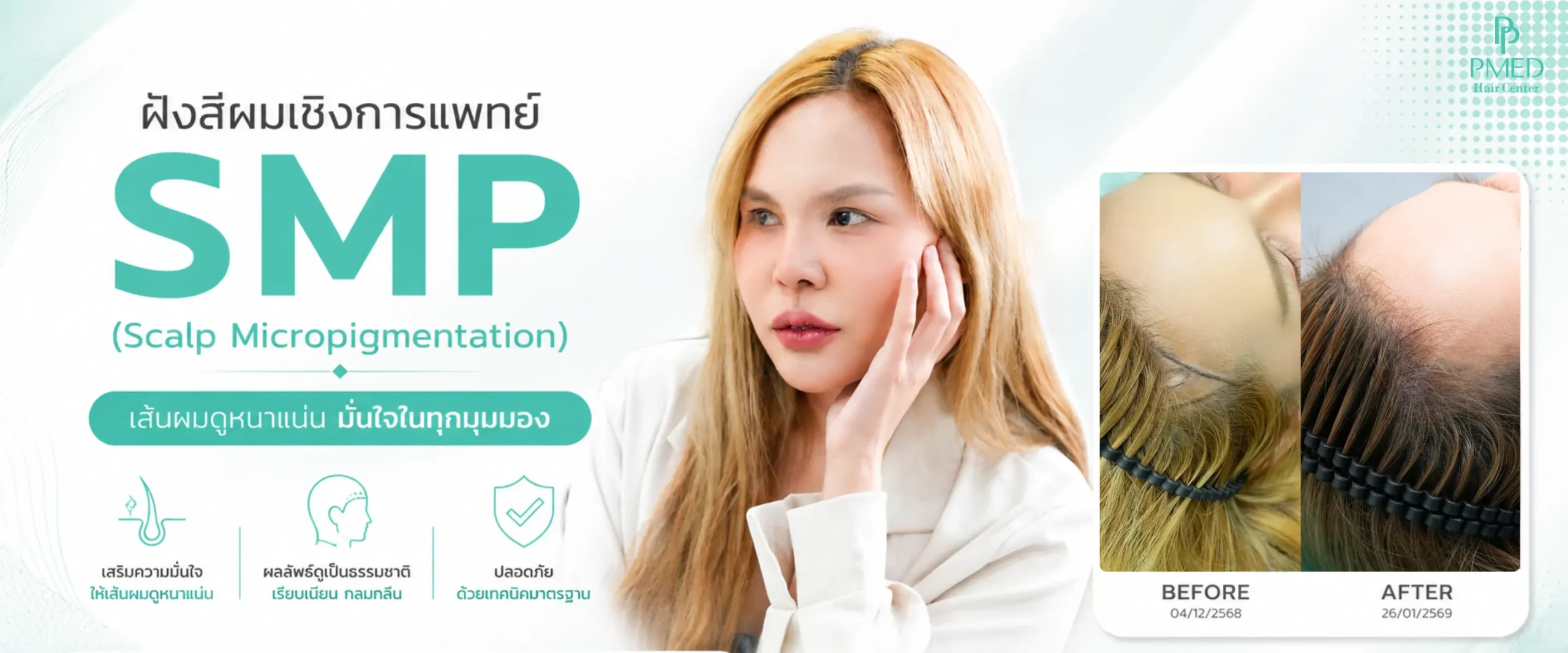 แบนเนอร์หน้าSMP 1