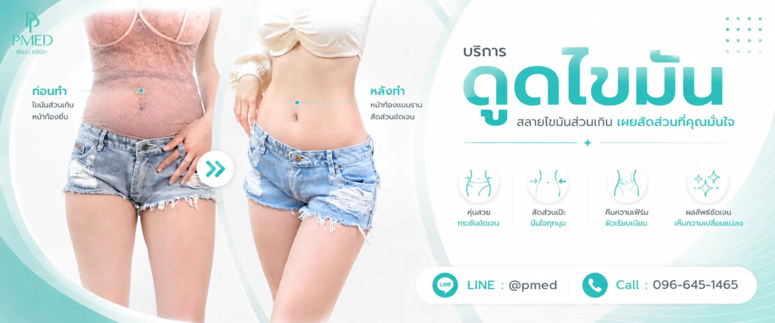 แบนเนอร์หน้าดูดไขมัน 2