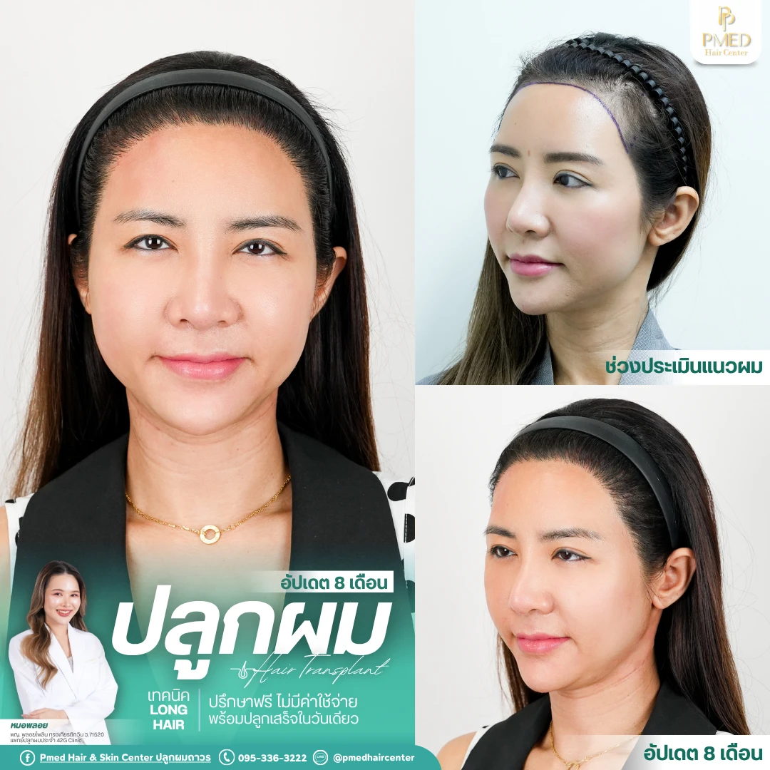 โพสต์ยิงAds (2)