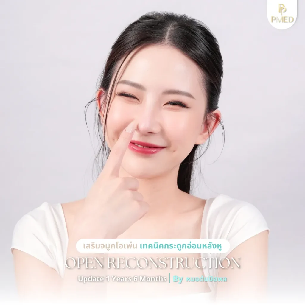 ทรงจมูกยอดนิยมเทรนด์ใหม่ล่าสุด เสริมให้สวยละมุน ดูเป็นธรรมชาติ