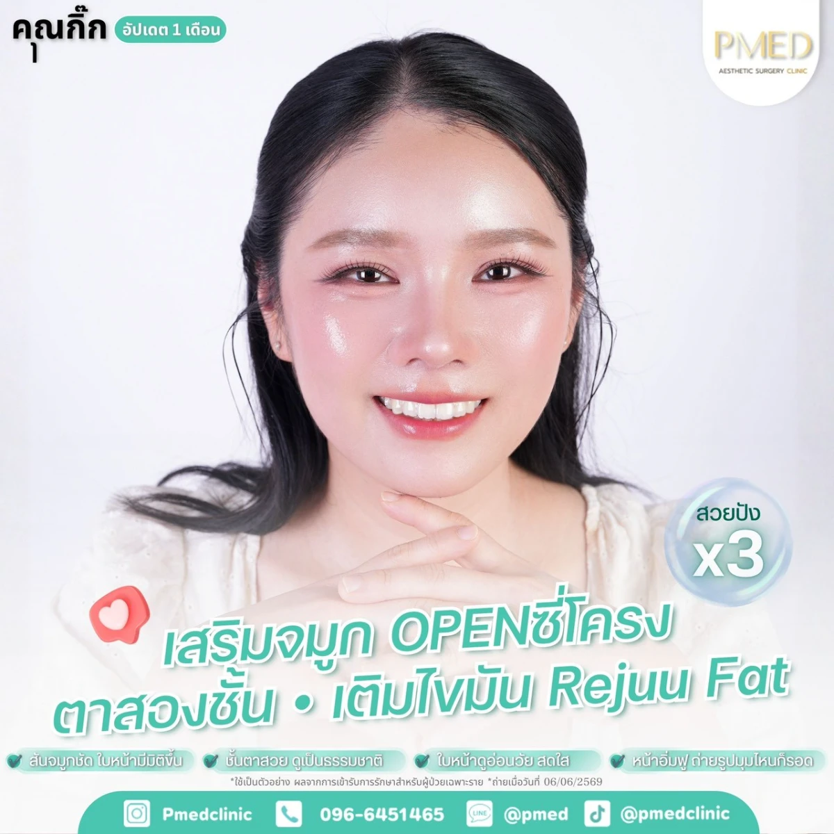 LINE_ALBUM_จมูก + ไขมัน 👃🏻👧🏻_260716_10