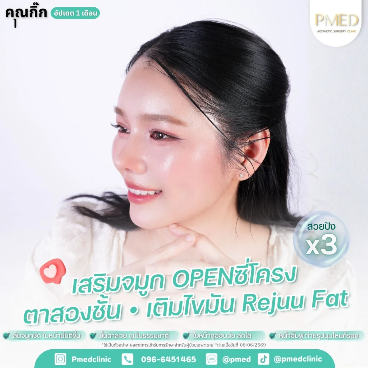 LINE_ALBUM_จมูก + ไขมัน 👃🏻👧🏻_260716_11