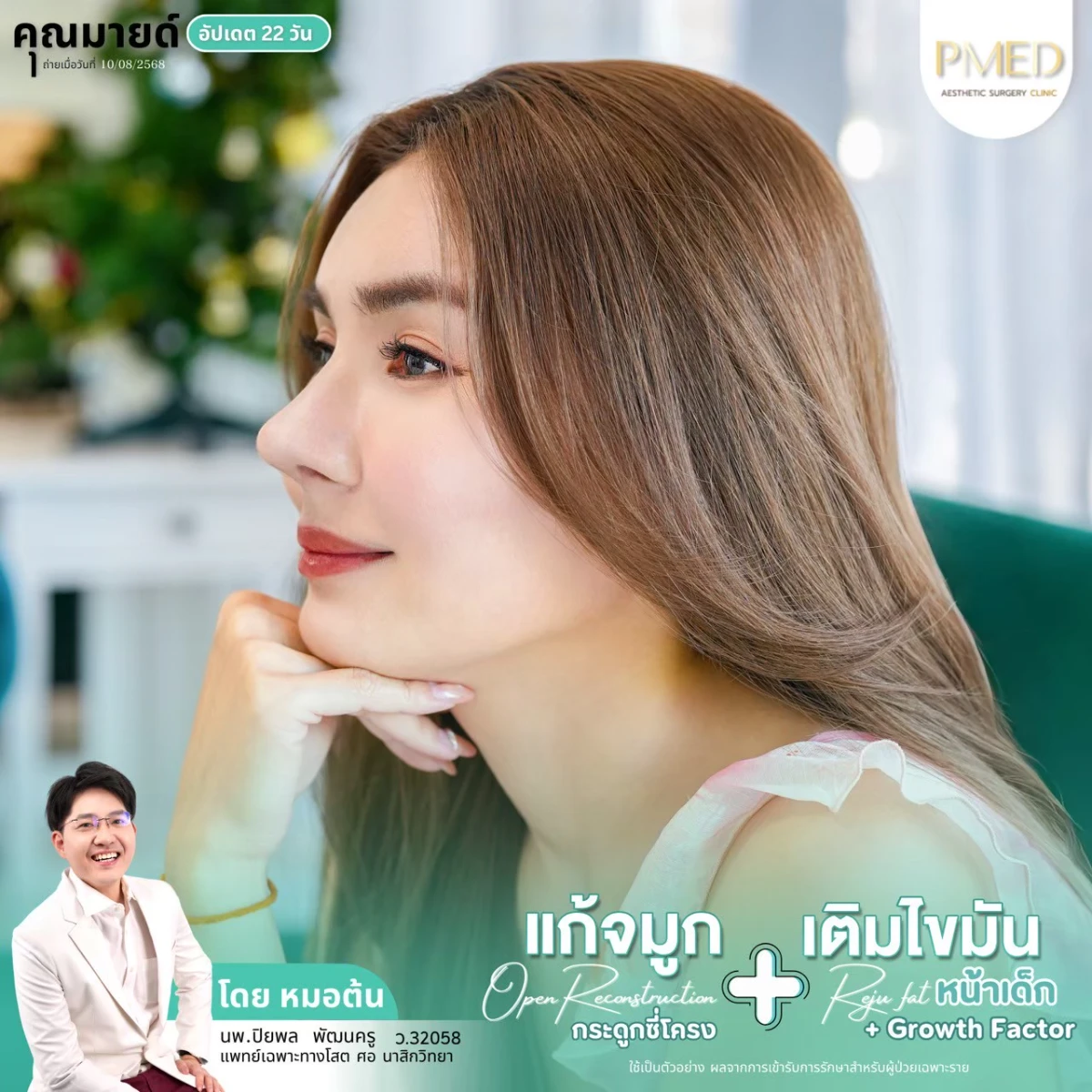 LINE_ALBUM_จมูก + ไขมัน 👃🏻👧🏻_260716_48