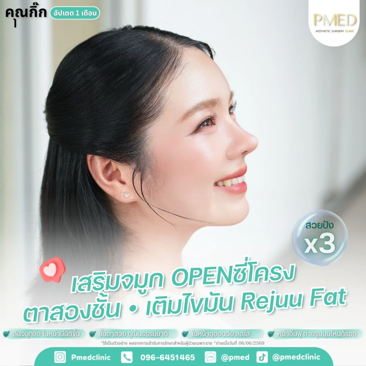 LINE_ALBUM_จมูก + ไขมัน 👃🏻👧🏻_260716_6