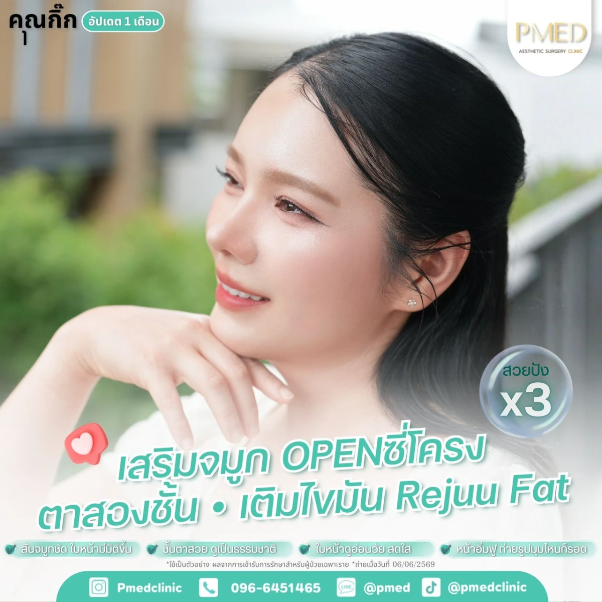 LINE_ALBUM_จมูก + ไขมัน 👃🏻👧🏻_260716_7
