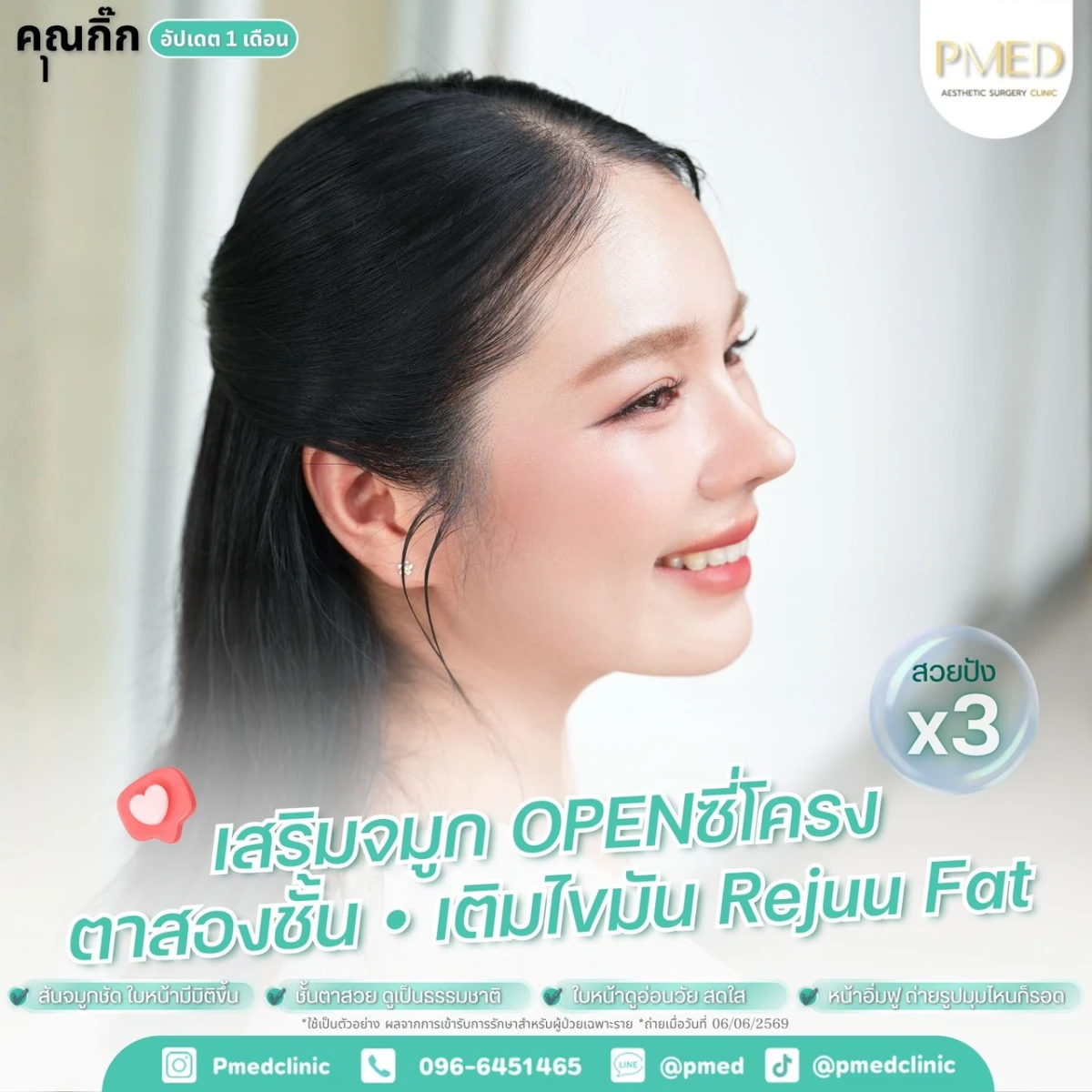 LINE_ALBUM_จมูก + ไขมัน 👃🏻👧🏻_260716_8