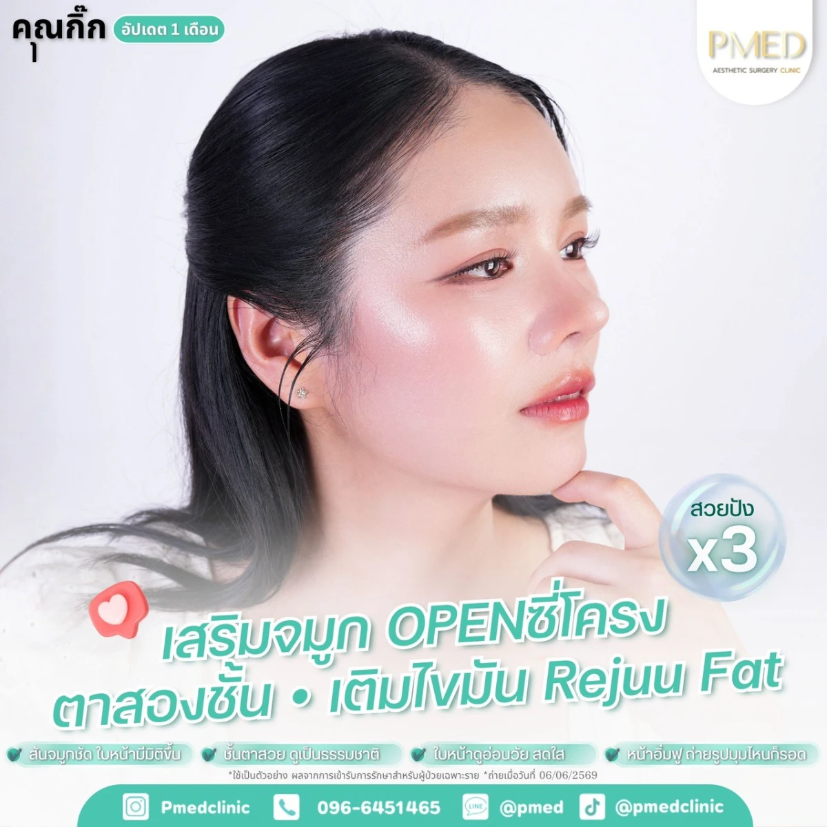 LINE_ALBUM_จมูก + ไขมัน 👃🏻👧🏻_260716_9
