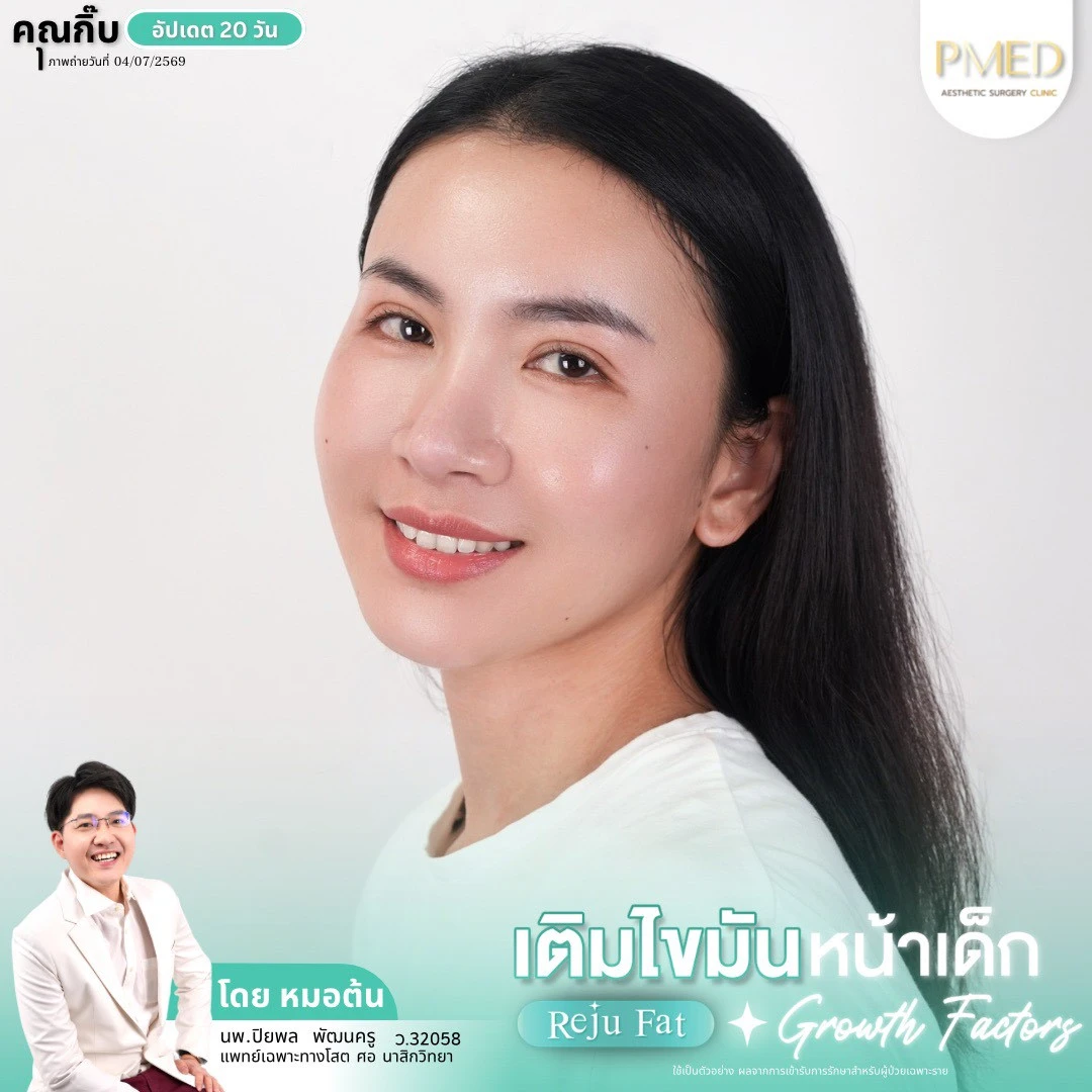 LINE_ALBUM_เติมไขมัน Reju Fat ✨_260715_1