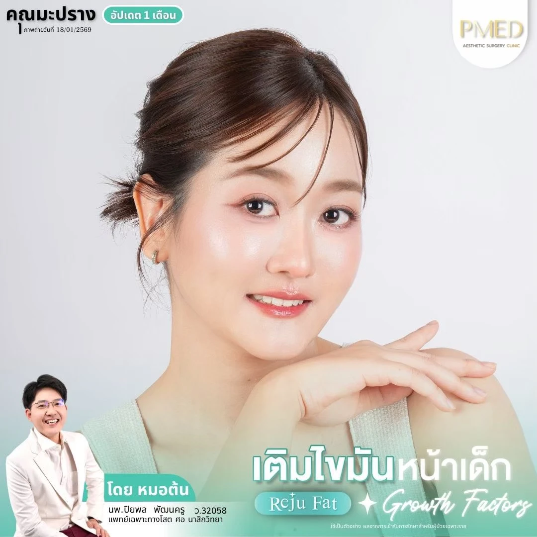 LINE_ALBUM_เติมไขมัน Reju Fat ✨_260715_10