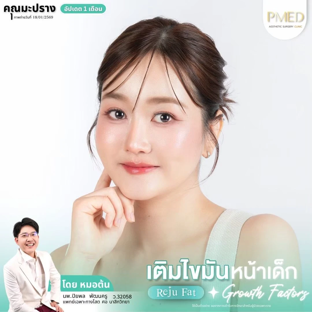 LINE_ALBUM_เติมไขมัน Reju Fat ✨_260715_11