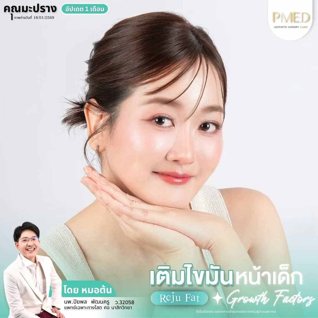 LINE_ALBUM_เติมไขมัน Reju Fat ✨_260715_12