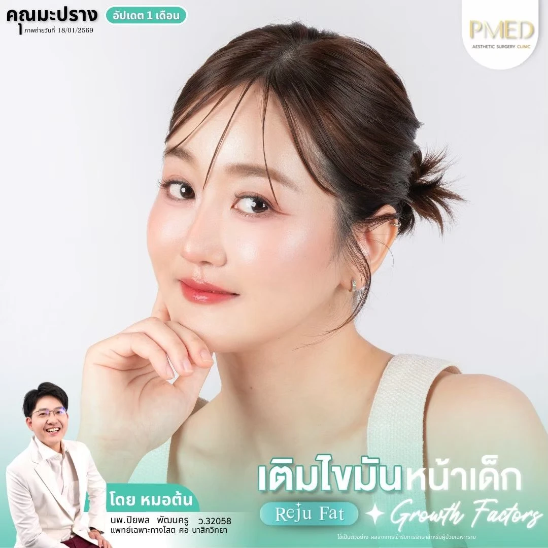 LINE_ALBUM_เติมไขมัน Reju Fat ✨_260715_13