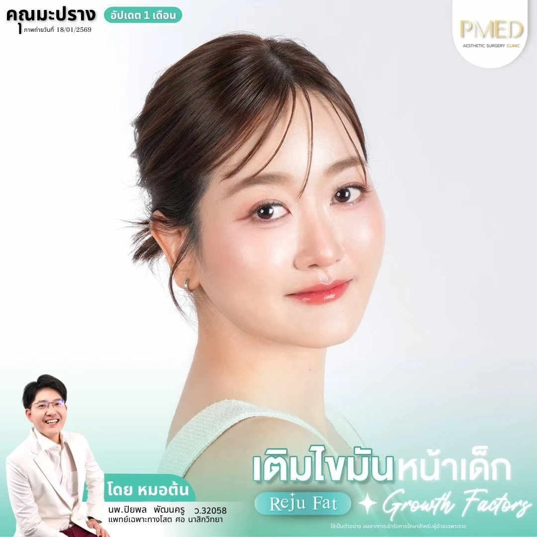 LINE_ALBUM_เติมไขมัน Reju Fat ✨_260715_14