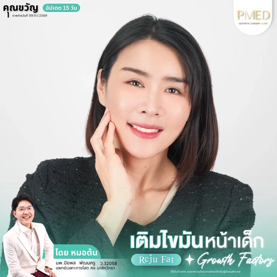 LINE_ALBUM_เติมไขมัน Reju Fat ✨_260715_18