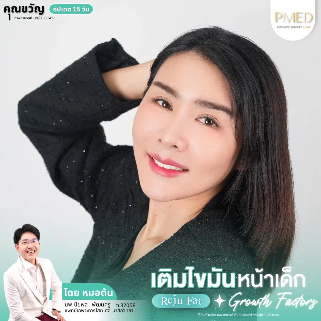 LINE_ALBUM_เติมไขมัน Reju Fat ✨_260715_19