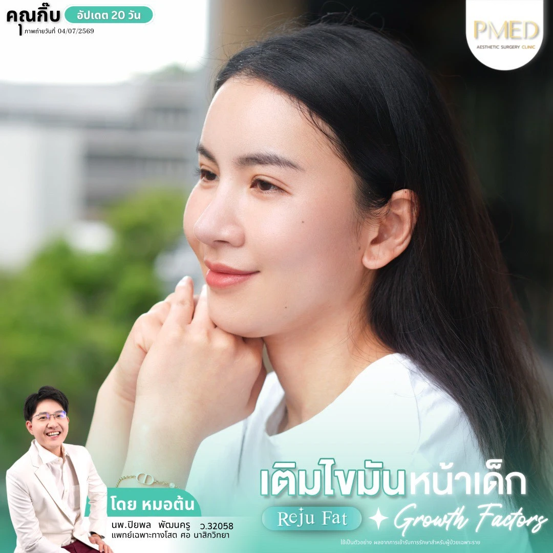 LINE_ALBUM_เติมไขมัน Reju Fat ✨_260715_2