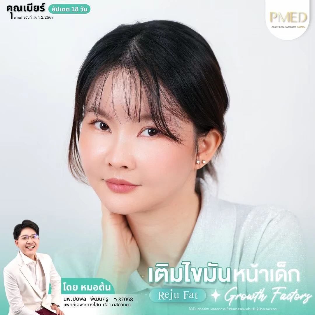 LINE_ALBUM_เติมไขมัน Reju Fat ✨_260715_20